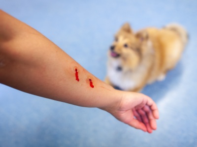 狗咬了人怎么赔偿 如果拒不赔偿会坐牢吗