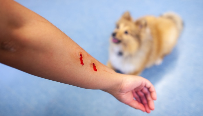 动物损害侵权责任由谁承担 赔偿范围是什么