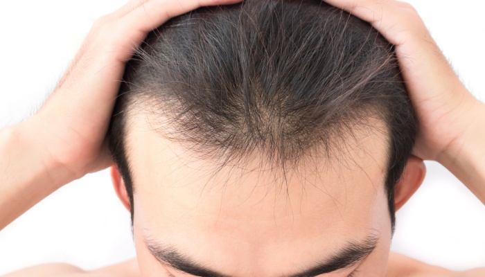 中年失业后领取失业金有影响吗 需要什么条件